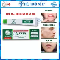 Kem Acnes Medical Cream ngăn ngừa mụn, giảm sưng, tái tạo da tuýp 18g