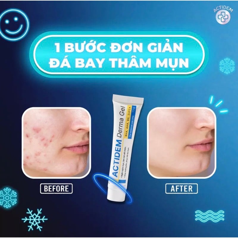 Actidem derma